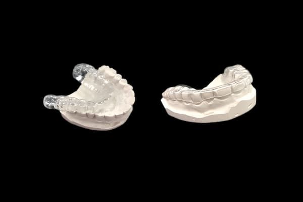Occlusal Gaurd
